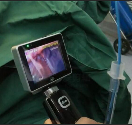 ICU EMS Single Use Intubation Video Laryngoscope With 1280 X 720 Camera Resolution