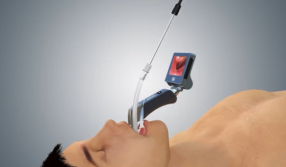 Reusable Stainless Steel Video Laryngoscope with 5 Blades for difficult airway intubation