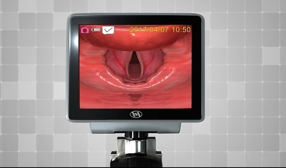 Handled Type 3.0 Inch Display Visual Laryngoscope for ICU Emergency Clinical Airway Intubtion