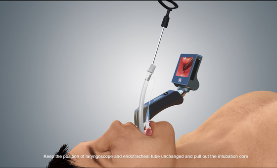 HYHJ-KC Waterproof Medical Surgical Video Laryngoscope LED Light Source