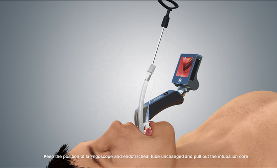 Reusable Blades Fiber Optic Mcgrath Video Laryngoscope ISO13485