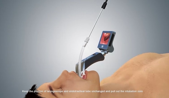 HYHJ-KC Medical-Grade Metal Material Digital Anti Fog Camera System Video Laryngoscope
