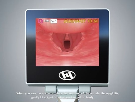 Ambulance ENT Rigid Anesthesia Video Laryngoscope With Difficulty Blade
